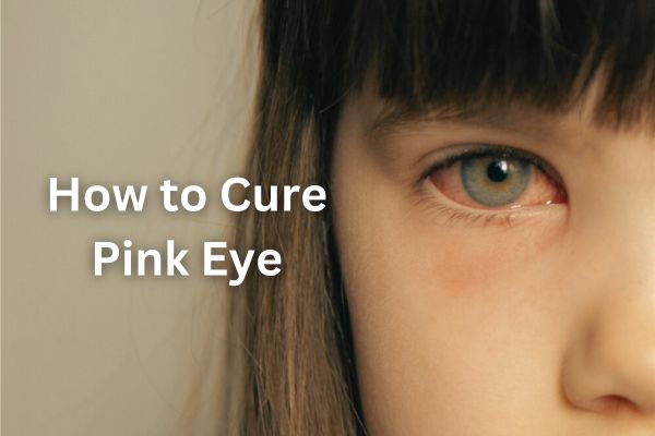 Medicine For Pink Eye, How to Cure